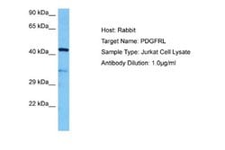 PDGFRL Rabbit anti-Human, Polyclonal, Novus Biologicals 0.1 mL | Buy Online | Novus Biologicals | Fisher Scientific